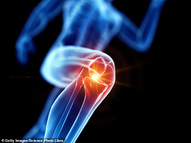 The degenerative joint disease affects about ten million Britons. More than half of cases strike the knee, with 100,000 people a year ending up on the NHS waiting list for joint replacement surgery
