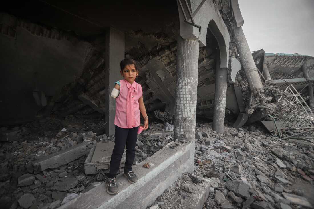 Palestinian girl Gade Debabesh is seen in Gaza City, on April 22, after part of her arm was amputated.