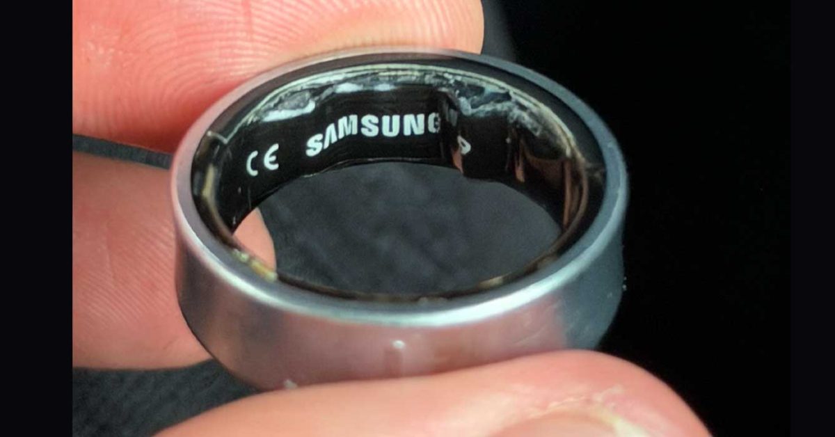 Swollen Galaxy Ring battery leads to hospital visit