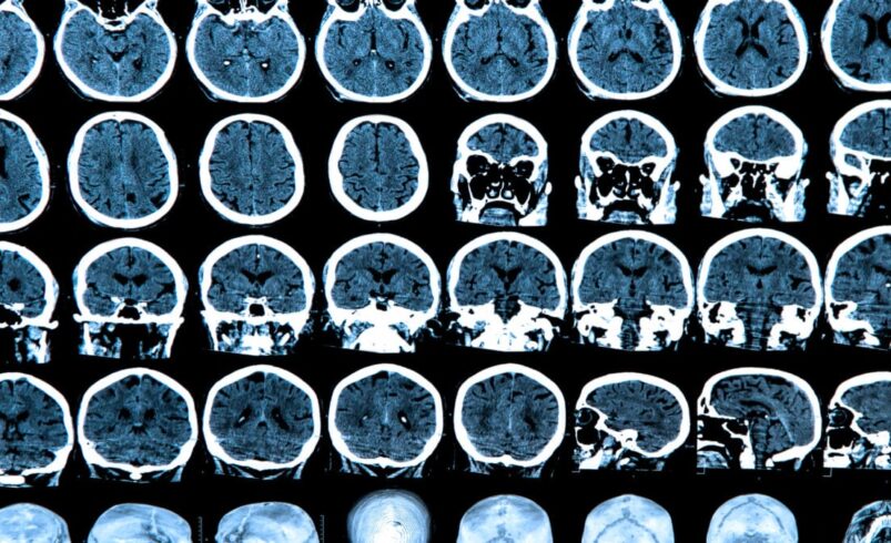 Scientists Might Be Looking for Consciousness in the Wrong Part of the Brain