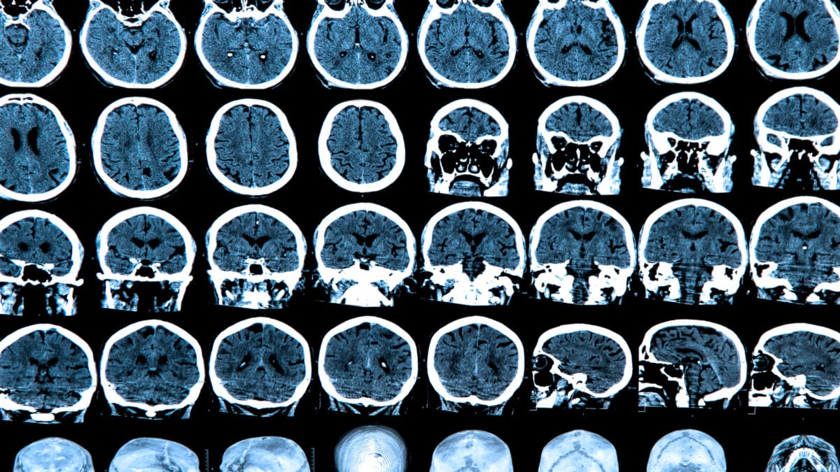 Scientists Might Be Looking for Consciousness in the Wrong Part of the Brain