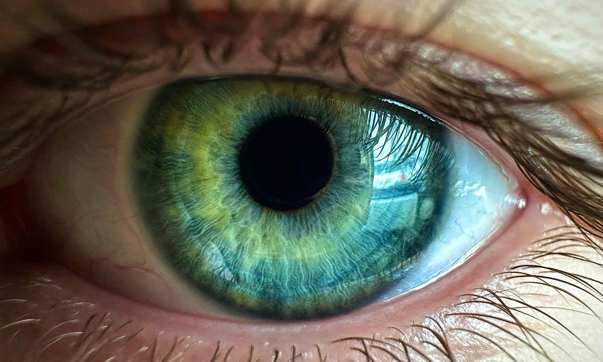 Popular weight-loss drugs may increase risk of vision loss